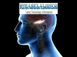 Implant otak
